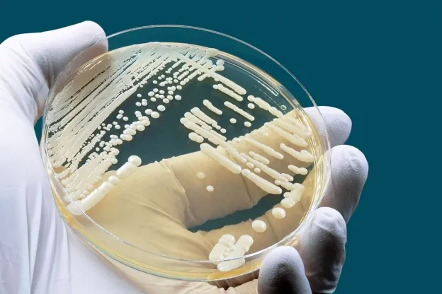NHIỄM NẤM CANDIDA ÂM ĐẠO 