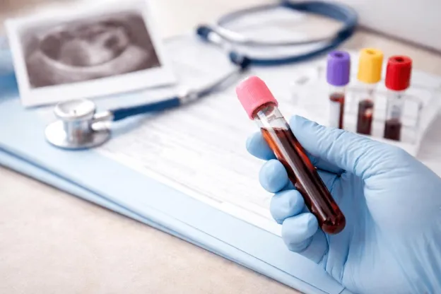 THALASSEMIA – BỆNH DI TRUYỀN GEN LẶN MÀ CÁC CẶP VỢ CHỒNG CHUẨN BỊ MANG THAI NÊN TẦM SOÁT