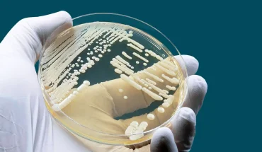 NHIỄM NẤM CANDIDA ÂM ĐẠO