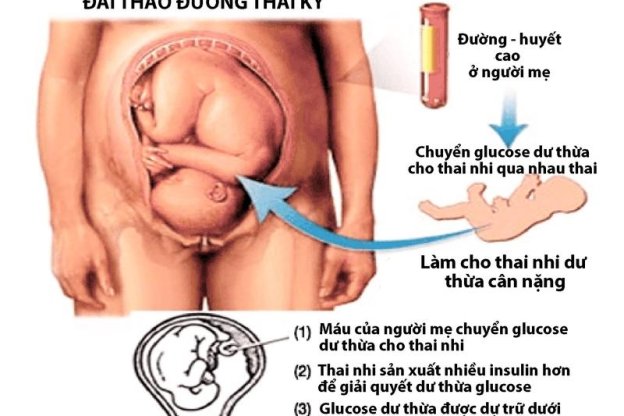 THAI TO CÓ NGUY HIỂM KHÔNG? NHỮNG ĐIỀU MẸ BẦU CẦN BIẾT