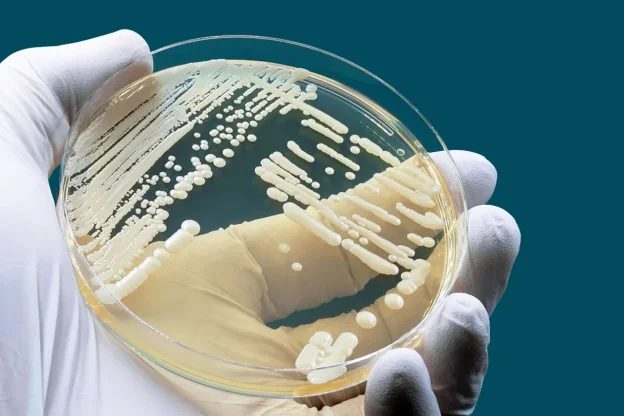 NHIỄM NẤM CANDIDA ÂM ĐẠO